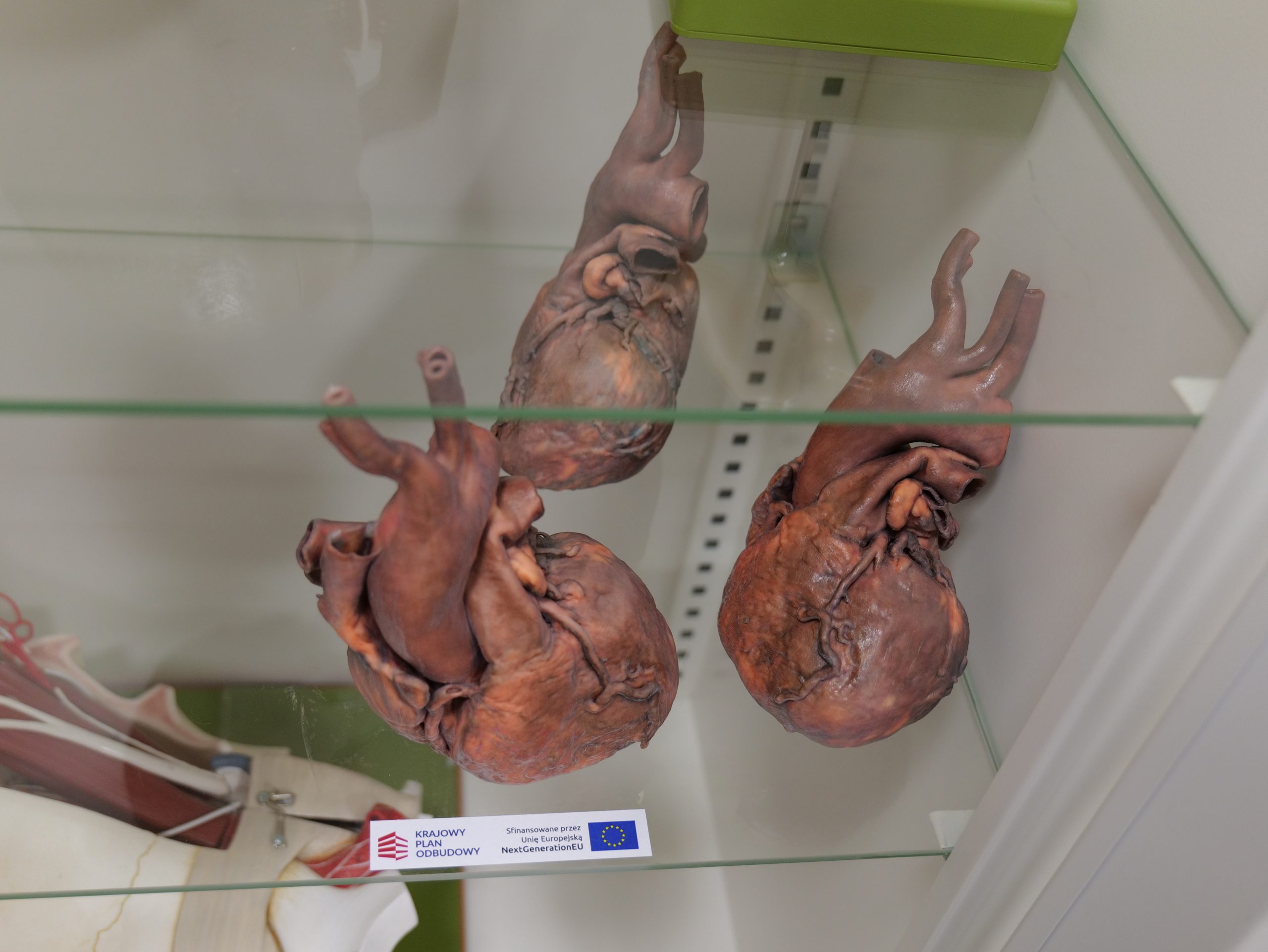 W gablocie dydaktycznej zaprezentowano preparaty anatomiczne serca, wykorzystywane do nauki budowy układu krążenia. Eksponaty ukazują szczegóły anatomiczne narządu, w tym przebieg dużych naczyń krwionośnych. Tego typu pomoce naukowe służą studentom do poznawania anatomii i fizjologii serca podczas zajęć praktycznych.